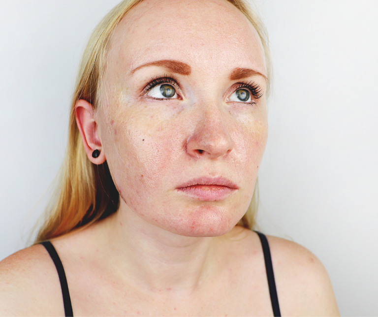 Kosmetyki do cery tłustej ogrody piękna