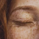 kwasy i retinoidy ogrody piękna